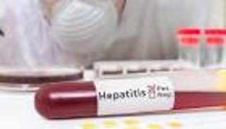 التهاب الكبد الفيروسي يصيب 1.5 مليون جزائري