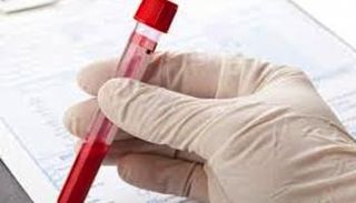 علاج جديد رائد في مجال مكافحة السرطان