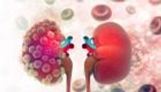 أسباب وأعراض الفشل الكلوي.. ونصائح للوقاية منه