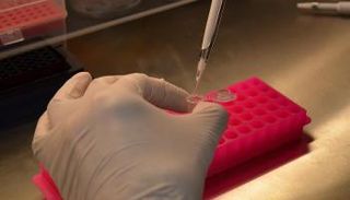 علماء يطورون عقارا يقضي على فرص عودة سرطان المبيض بنسبة الثلثين