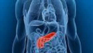 دراسة أمريكية: مركب مشتق من شجرة صينية يقضي على أورام البنكرياس