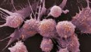 اكتشاف جزيئات بخلايا الجسم قادرة على تدمير السرطان