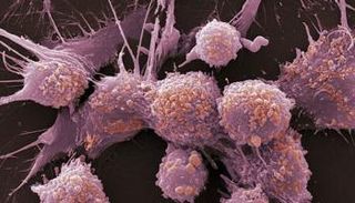 خلايا سرطانية