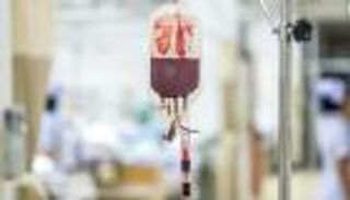 نقل دماء من الشباب لمرضى ألزهايمر يخفف من أعراض الخرف