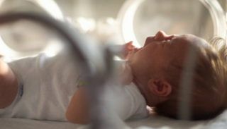 فرنسا تفتح تحقيقا بعد زيادة العيوب الخلقية بين المواليد