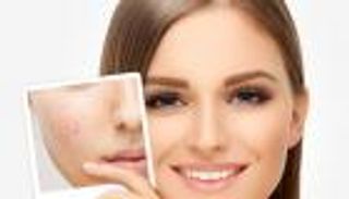 فوائد زبدة الكاكاو .. مصنع طبيعي للبروتين والكولاجين