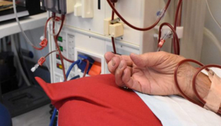 تحديد الجينات خطوة للقضاء على الفشل الكلوي