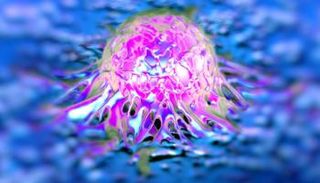 الاختبار كشف عن وجود خلايا سرطانية بدقة 90%