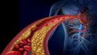رؤية صور الشرايين المسدودة تحفز الإنسان على الاهتمام بصحته