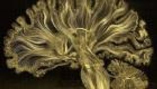 علماء صينيون يحاولون رسم خريطة ثلاثية الأبعاد لخلايا الدماغ البشري