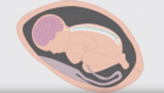 بريطانيا توفر جراحات العمود الفقري للأجنّة مجانا