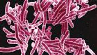 دراسة أمريكية تكتشف طفرات وراثية مسؤولة عن الإصابة بالسل