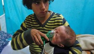 طفل مصاب باختناق نتيجة قصف قوات النظام السوري 