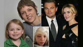 كيت وليو ينقذان سيدة من السرطان