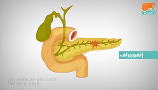 أطعمة لتحسين وظائف البنكرياس