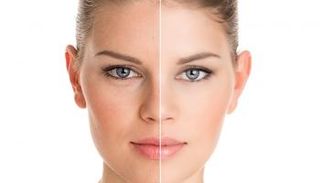 زيادة الإقبال على عمليات التجميل 