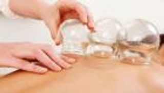 8 فوائد علاجية للحجامة.. تعرف عليها 