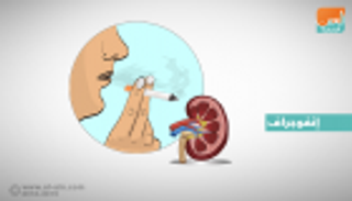 إنفوجراف.. 7 أضرار للتدخين على مرضى الكلى