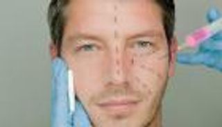 أكثر 3 عمليات تجميل يجريها الرجال