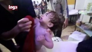 طفل مصاب بأعراض اختناق من غاز الكلور  في دوما - رويترز