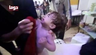 أطفال دوما يصارعون بعد الهجوم الكيماوي