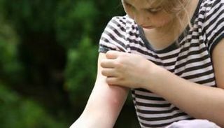 زيادة في انتشار الأمراض التي ينقلها البعوض والبراغيث في أمريكا