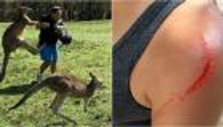 بالصور.. الكانجارو يهاجم السياح في أستراليا بعد إطعامه وجبات سريعة 