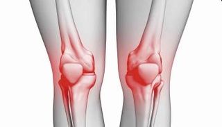 نقص الكالسيوم يؤدي إلى هشاشة العظام