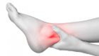 واحد من كل 4 إماراتيين يعاني من آلام الكاحل وتصلب القدمين