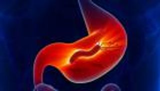 قرحة المعدة.. الأسباب والأعراض والعلاج