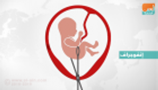 إنفوجراف.. الإجهاض في أوروبا بين الإجازة المشروطة والمنع المطلق