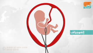 الإجهاض يثير الجدل في أوروبا