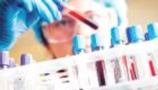 نتائج واعدة لفحص دم يكشف سرطان الرئة مبكرا