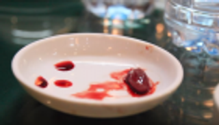 أطعمة "غريبة" يعتبرها البعض "شهية"