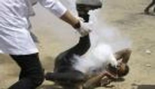 قناص إسرائيلي يحول وجه الفلسطيني هيثم أبو سبلة إلى فوهة بركان