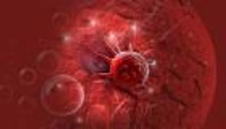 علاج جديد يمنع انتشار 4 أمراض سرطانية