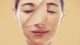 طريقة ترطيب البشرة الجافة بمكونات طبيعية