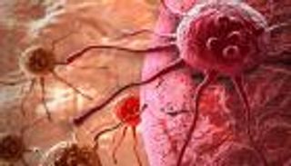 فيروس شلل الأطفال أمل جديد لمرضى سرطان الدماغ