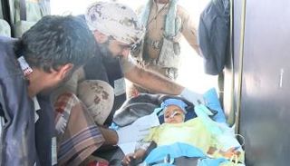 نقل الطفلة اليمنية 