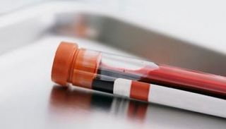 تحليل جديد للدم يتوقع العمر المتبقي للإنسان