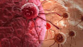 طريقة جديدة لمنع تطور السرطان في مراحله النهائية