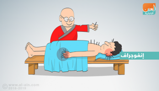 الجلطة الدماغية.. وصفة من الطب الصيني القديم