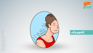 أبرز 10 أمراض تعالجها الإبر الصينية