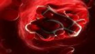 قاوم الجلطات الدموية بـ3 طرق بسيطة