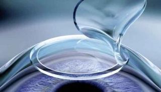 قرنية عين - أرشيفية