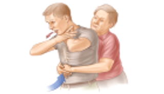 خطوات بسيطة لإسعاف المصابين باختناق الطعام