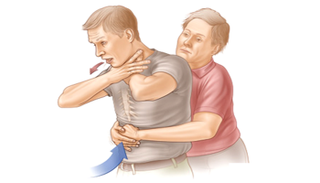 مناورة هيمليك من أهم طرق إسعاف المصابين باختناق الطعام