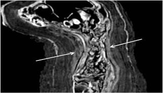 التصوير المقطعي المحوسب