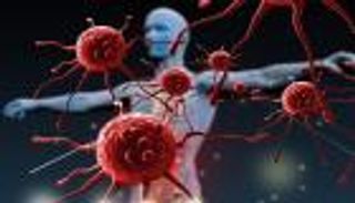 سرطان الجلد الحليم يزيد خطر الإصابة بأنواع أخرى