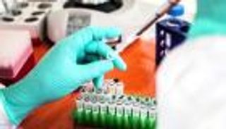 الكونغو تبدأ علاجا تجريبيا للإيبولا 